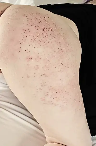 New favorite toy - needle paddle